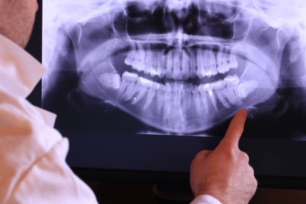 Best Emergency Cosmetic Dentistry (e.g., broken veneers) in Peachtree Corners, GA